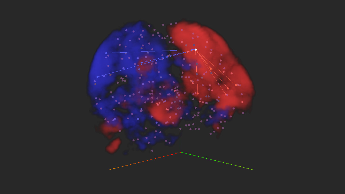 A 3d plot of  brain regions as spheres, with lines connecting correlated regions