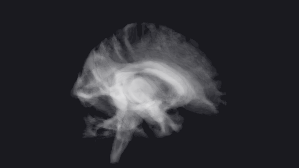 An image of white matter tracts in the brain, generated using parobabilistic tract tracing. Lightness represents the probability that a white-matter tract from the region of interest passes through the voxel in a pool of subjects.